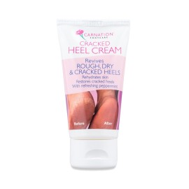 Carnation Cracked Heel Cream Cream for cracked heels 50ml.